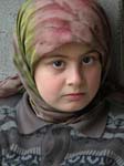 iraq, leukemia patient